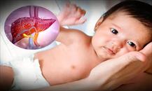 Bệnh gan ở trẻ em: Nguyên nhân, triệu chứng và cách phòng bệnh