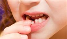 Chăm sóc răng cho trẻ trong độ tuổi thay răng