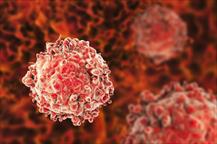 Ghép tế bào gốc - phao cứu sinh cho người ung thư máu