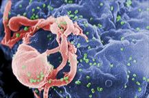 Bệnh nhân thứ 5 khỏi HIV nhờ ghép tế bào gốc