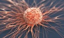 6 thói quen hạn chế nguy cơ tái phát ung thư