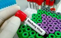 Những điều cần biết về bệnh do virus Marburg