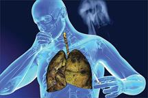 Nguyên nhân ung thư phổi khiến nhiều người tử vong