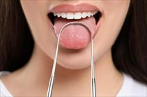 Loại vi khuẩn vùng miệng có thể gây ung thư