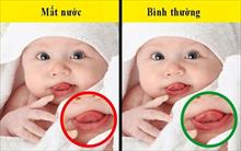 Trẻ bị tiêu chảy do rotavirus, bố mẹ cần lưu ý gì?