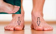 Cần đi khám thận ngay lập tức nếu bàn chân xuất hiện dấu hiệu lạ