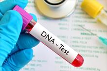 Xét nghiệm DNA để xem bạn có sống thọ hay không?