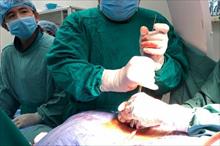Bắt vít qua da cố định cột sống cho bệnh nhân thoát vị đĩa đệm cột sống thắt lưng