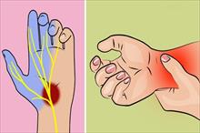 Khi thấy tay hoặc chân thường xuyên bị tê, hãy dè chừng những bệnh nguy hiểm sau