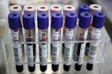 Trung Quốc khẳng định lô huyết tương âm tính với HIV