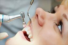 Những dấu hiệu 'tố cáo' răng của bạn có vấn đề