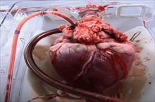 Các bác sĩ làm thế nào để giữ quả tim cấy ghép luôn đập trong ca phẫu thuật?