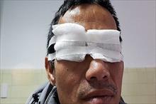 Một nam giới đối mặt với nguy cơ mù mắt phải vì 