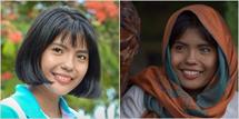 Cô gái Việt Nam xinh đẹp có đôi mắt hai màu: Căn bệnh hiếm gặp trên thế giới