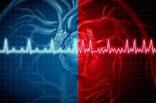Phát hiện rối loạn nhịp tim trong 10 giây nhờ trí tuệ nhân tạo