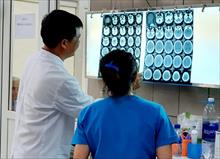 Ca bệnh đầu tiên ở Việt Nam: Nam thanh niên 27 tuổi xuất huyết não sau khi dùng ma túy đá