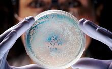 Vi khuẩn thay đổi hình dạng để kháng kháng sinh