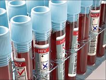 Năm 2021 sẽ có vắcxin chống HIV