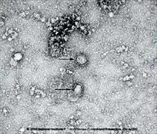 Chuyên gia Australia nuôi cấy thành công chủng coronavirus mới